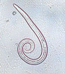 Aelurostrongylus abstrusus-1414DE3DB9914D54806.jpg